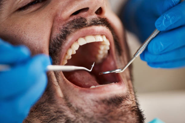 Best Walk-In Emergency Dentist in Muleshoe, TX