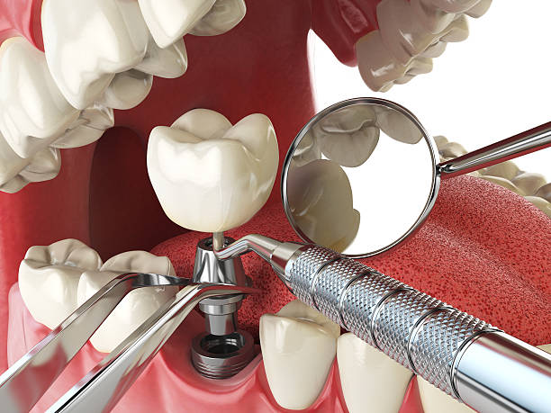 Best Emergency Broken Tooth Repair in Muleshoe, TX